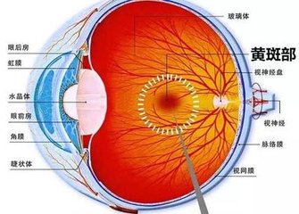 黃斑變性是怎么回事？黃斑變性的方法？